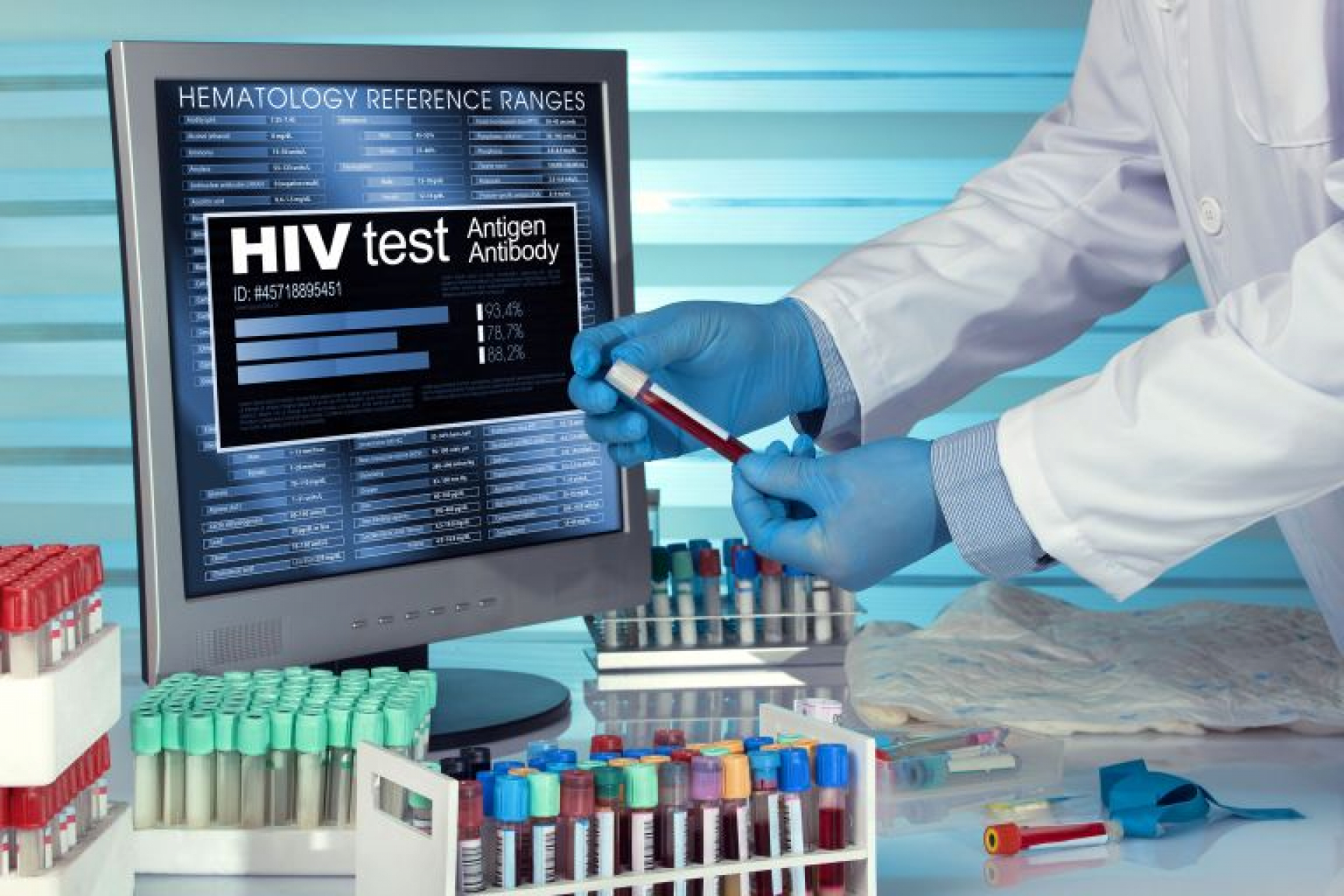 40 éve jelent meg a HIV